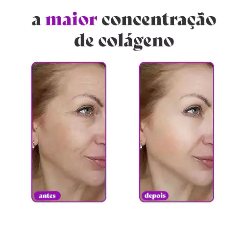 CollagenBoost - Máscara rejuvenescedora de Colágeno com Ácido Hialurônico