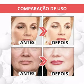 Collagen Boost - [TRATAMENTO DE MINUTOS] + 1 BRINDE EXCLUSIVO