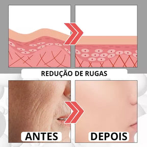 Collagen Boost - [TRATAMENTO DE MINUTOS] + 1 BRINDE EXCLUSIVO